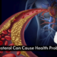 Cholesterol Can Trigger Health Problems - dr siddhant jain
