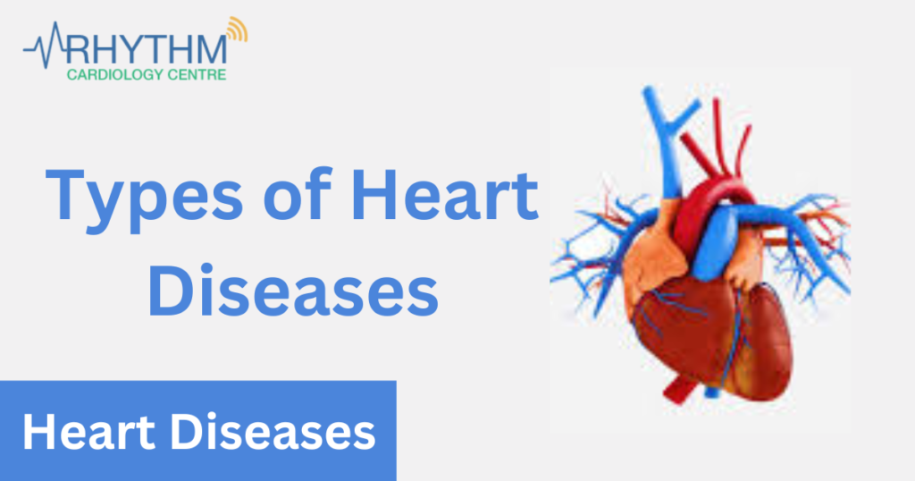 Types of Heart Diseases - Heart Specialist in Indore