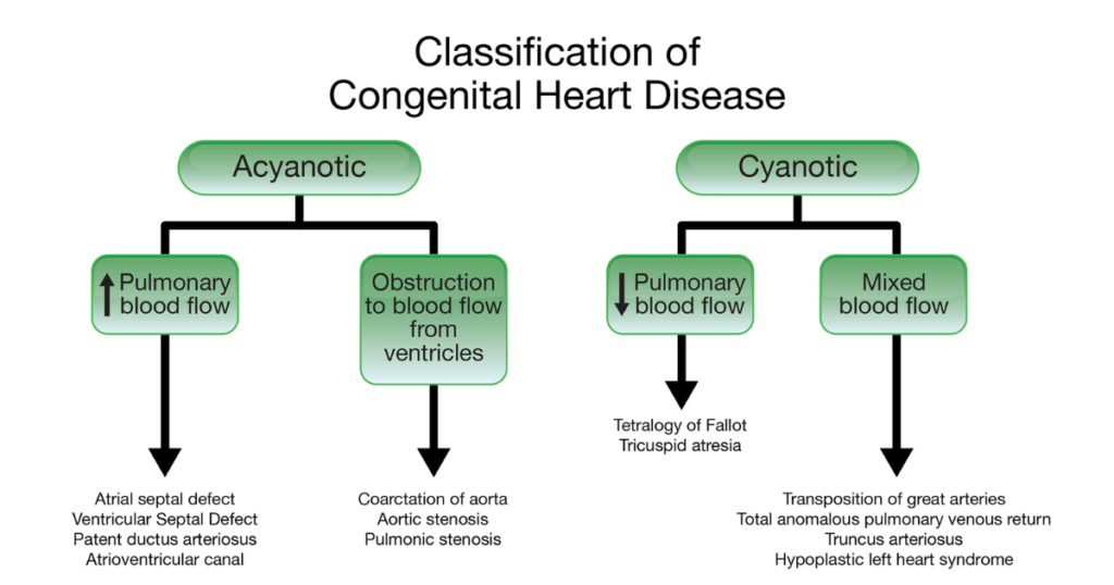 Types of Congenital Heart Disease