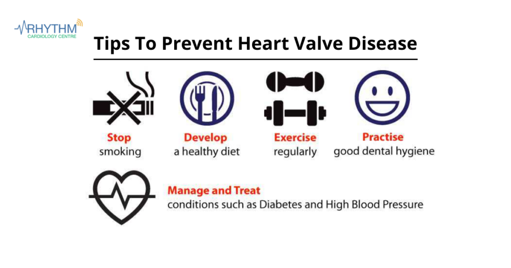 Tips To Prevent Heart Valve Disease - Cardiologist Indore