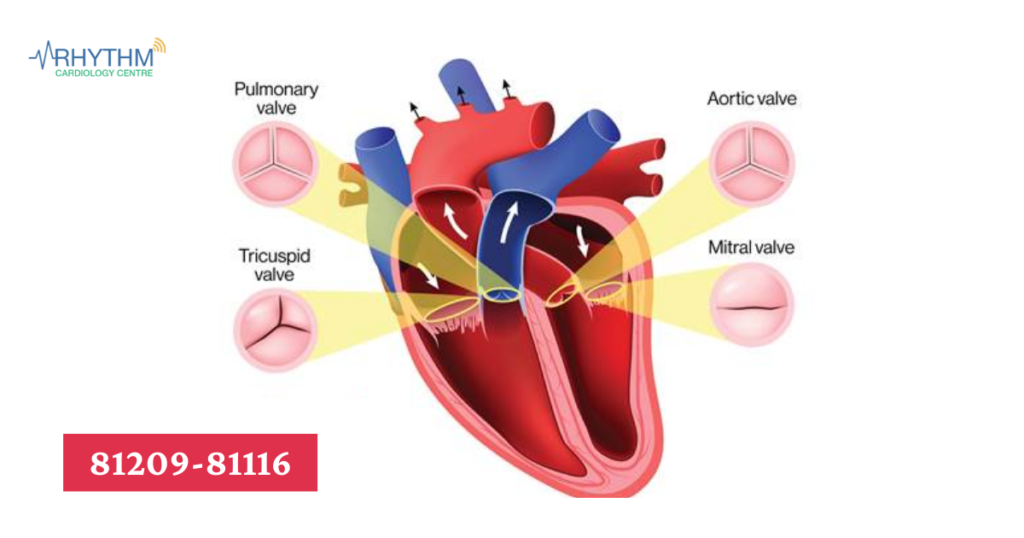 types of heart valve - dr siddhant jain